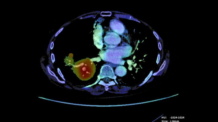 TMC Radiology AI Centre of Excellence